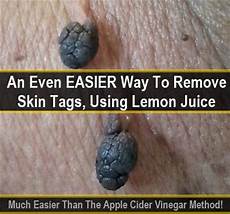Cider Vinegar