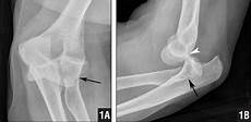 Reducing Elbow